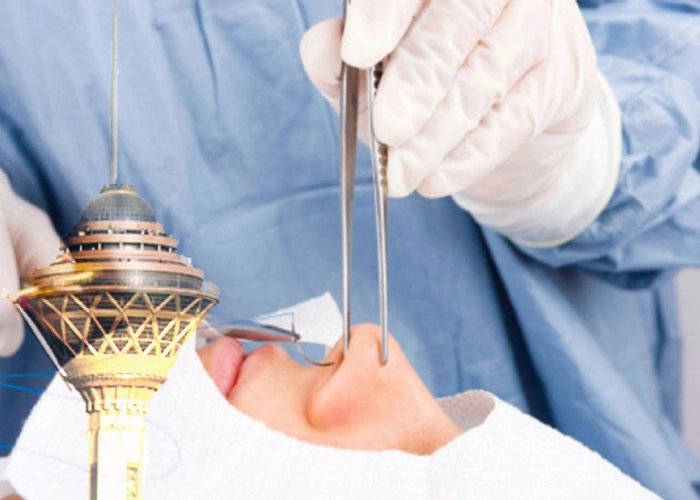 معرفی بهترین جراح بینی استخوانی در تهران- دکتر کامبیز پوریوسف