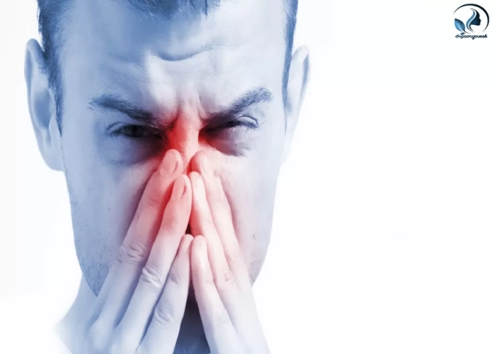 ورم بینی بعد از جراحی بینی- دکتر کامبیز پور یوسف