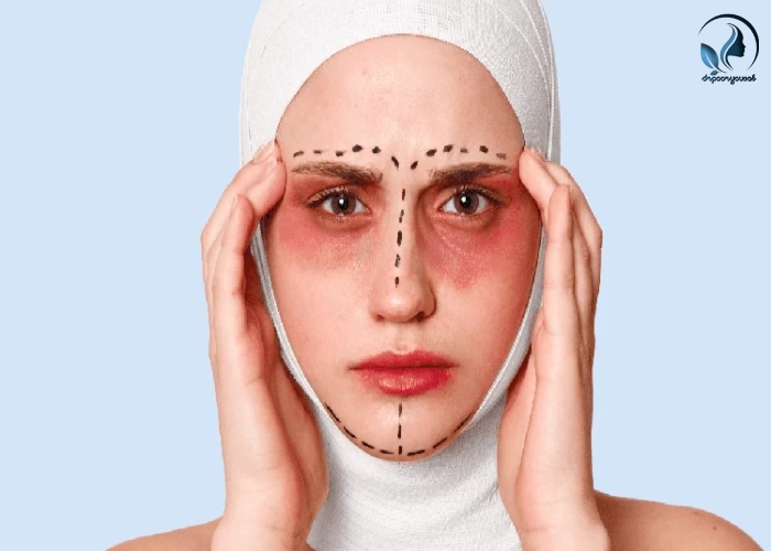 عوارض احتمالی جراحی بینی فانتزی