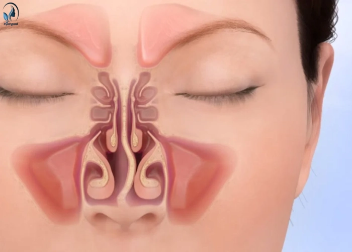 گرفتگی بینی بعد از جراحی بینی- دکتر کامبیز پور یوسف