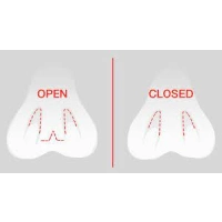 تنوع تکنیک‌های جراحی بینی