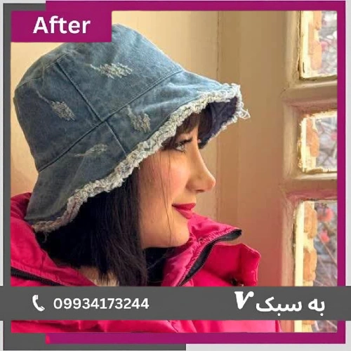 قوس کنترل‌شده و تیپ ظریف؛ دکتر آرزو خوانساری‌نیا | بهترین جراح بینی نیمه فانتزی در تهران