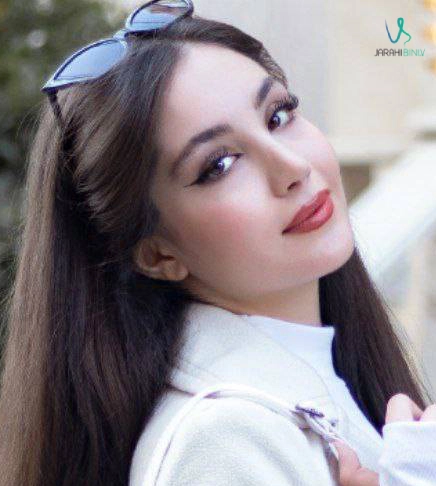 ترمیمی نیمه فانتزی با حداقل کبودی؛ دکتر آرزو خوانساری‌نیا | بهترین جراح بینی نیمه فانتزی در تهران