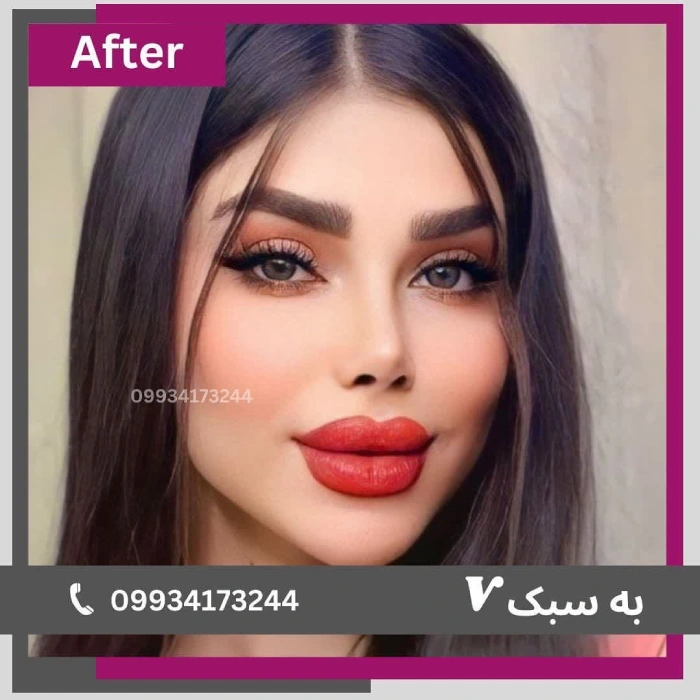 فرم نیمه فانتزی هماهنگ با چهره؛ دکتر آرزو خوانساری‌نیا | بهترین جراح بینی نیمه فانتزی در تهران