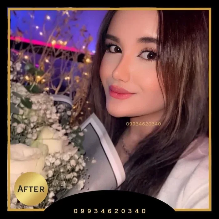 قوس کنترل‌شده و تیپ ظریف؛ دکتر اکبر اعتمادی | بهترین جراح بینی نیمه فانتزی در تهران