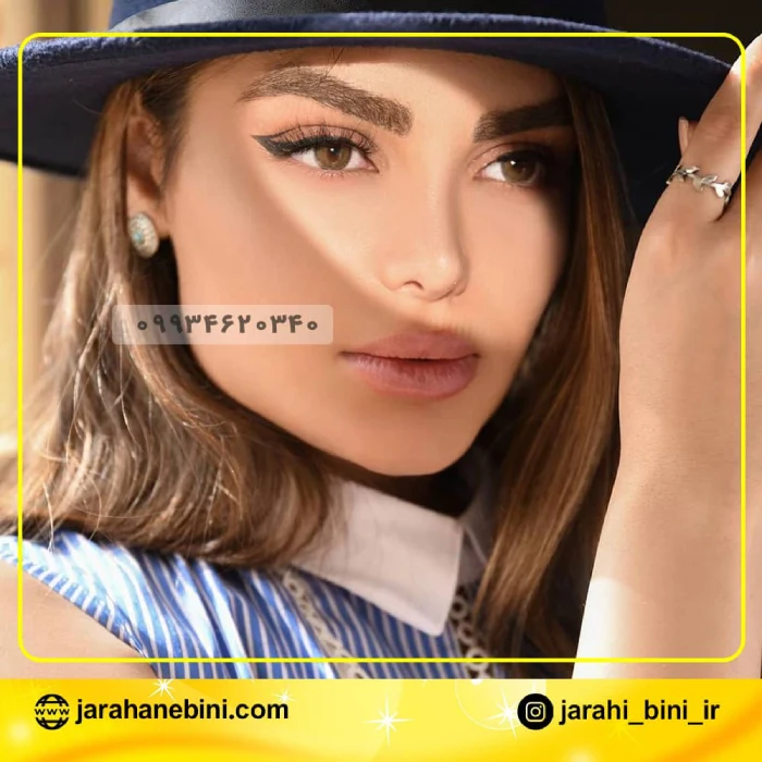 ترمیمی نیمه فانتزی با حداقل کبودی؛ دکتر اکبر اعتمادی | بهترین جراح بینی نیمه فانتزی در تهران