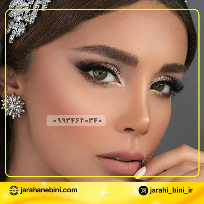 نتیجه ماندگار نیمه فانتزی؛ دکتر اکبر اعتمادی | بهترین جراح بینی نیمه فانتزی در تهران