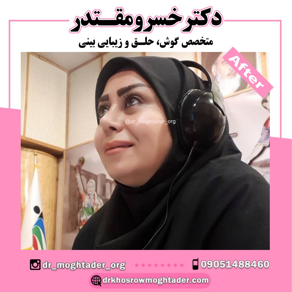 ترمیمی نیمه فانتزی با حداقل کبودی؛ دکتر خسرو مقتدر | بهترین جراح بینی نیمه فانتزی در تهران