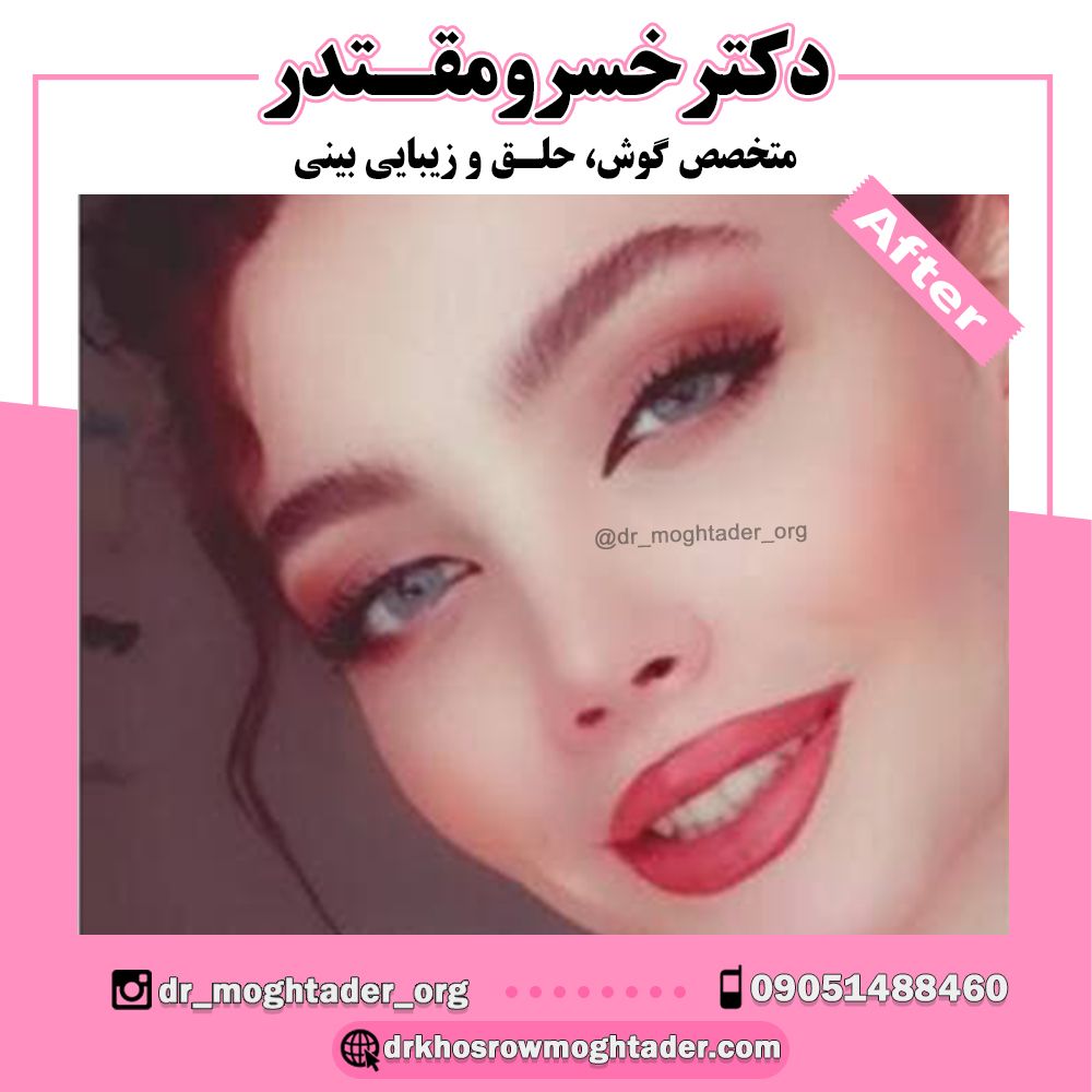 طراحی اختصاصی نیمه فانتزی؛ دکتر خسرو مقتدر | بهترین جراح بینی نیمه فانتزی در تهران
