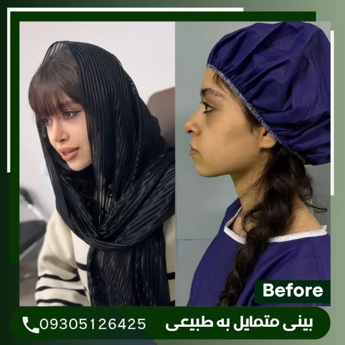 قوس کنترل‌شده و تیپ ظریف؛ دکتر علی شکرریز | بهترین جراح بینی نیمه فانتزی در تهران