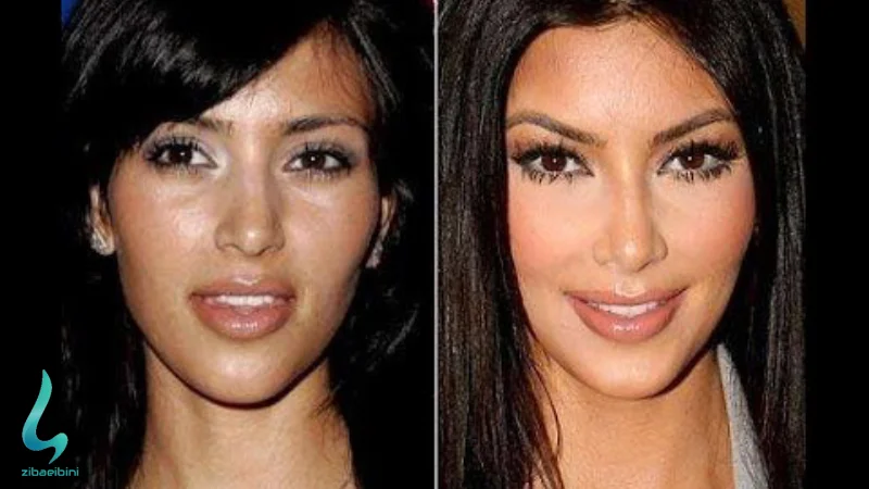 انتخاب مدل بینی بر اساس چهره