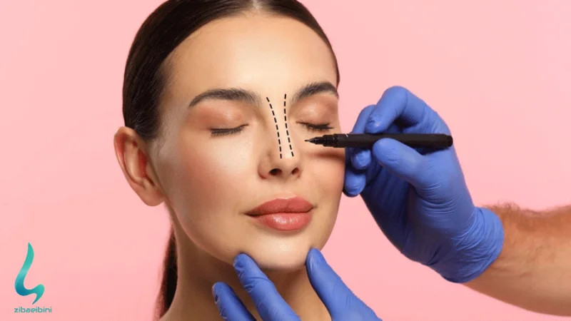 بهترین مدل بینی