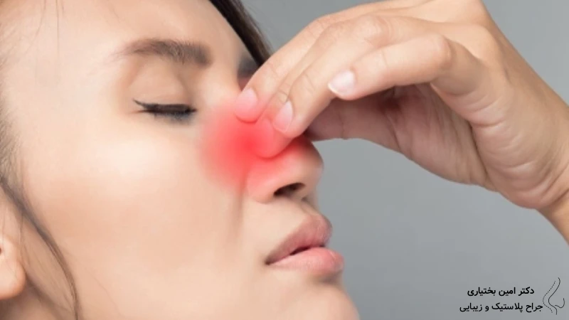 خطرناک بودن قرمزی نوک بینی بعد از عمل