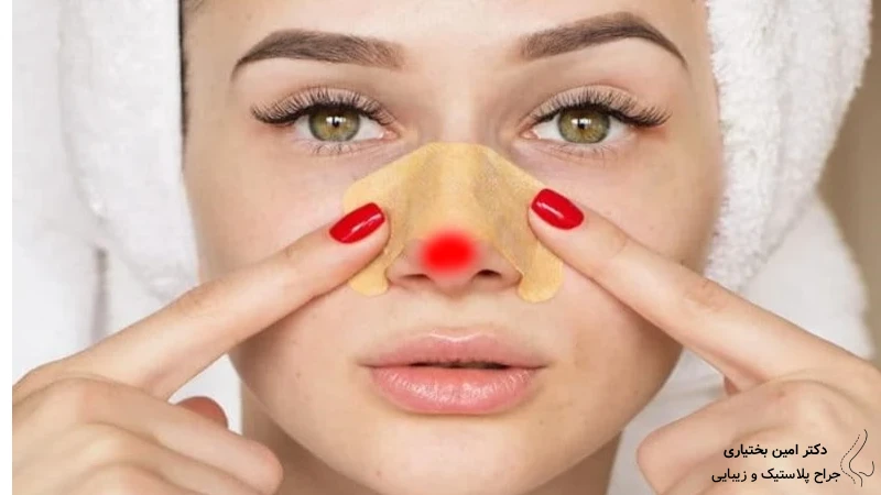 قرمزی نوک بینی بعد از عمل بینی - دکتر امین بختیاری