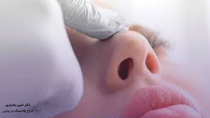 آیا رینوپلاستی بسته برای همه مناسب است؟