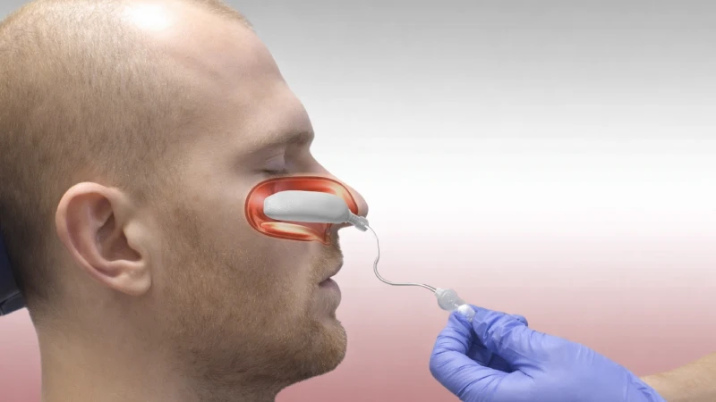 استفاده از تامپون بینی بعد از عمل