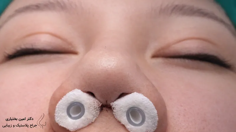 اشتباهات در استفاده از تامپون بینی