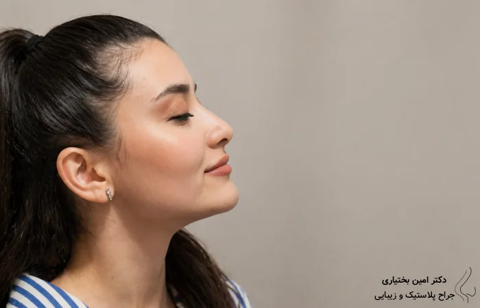 هزینه عمل بینی