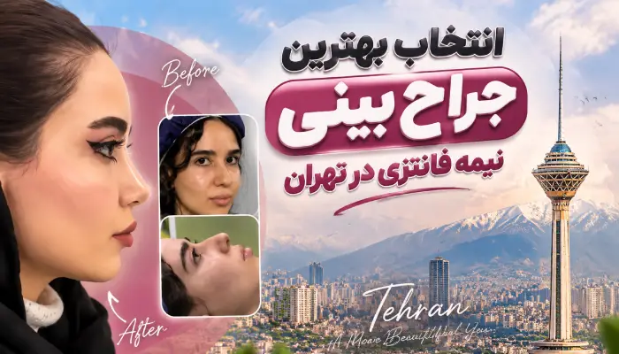 انتخاب بهترین جراح بینی نیمه فانتزی در تهران- دکتر امین بختیاری