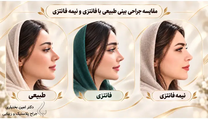 مقایسه بینی طبیعی با فانتزی و نیمه فانتزی