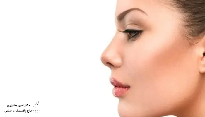 مقایسه قبل و بعد جراحی بینی فانتزی با اصلاح قوز و فرمدهی نوک بینی