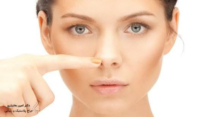 نمونه عمل بینی گوشتی از نمای روبهرو با کاهش پهنای نوک و حفظ تقارن